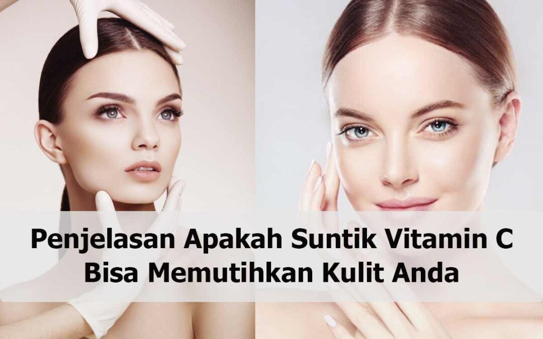 Penjelasan Apakah Suntik Vitamin C Bisa Memutihkan Kulit Anda